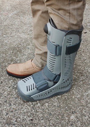 Possible Treatments of a Broken Ankle
