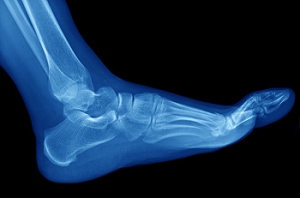 Symptoms of Rheumatoid Arthritis