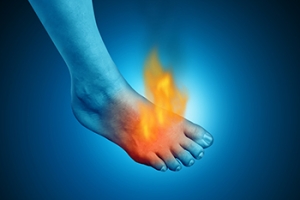 Exploring the Causes of Burning Feet